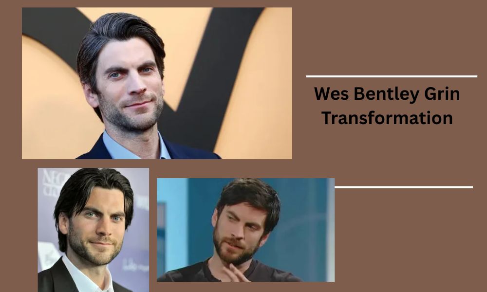 Wes Bentley smile evolution from American Beauty to Yellowstone. Veneers, whitening & a natural Hollywood transformation.